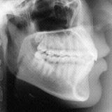 Radiologia Odontológica em Manaus